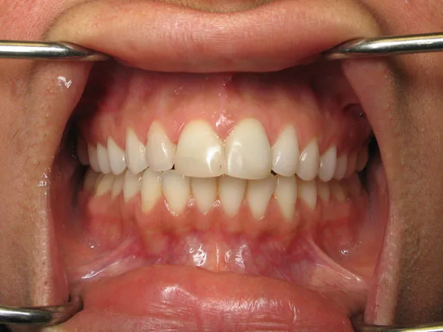 Smile Gallery image