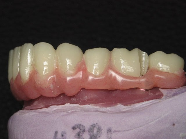 Smile Gallery image