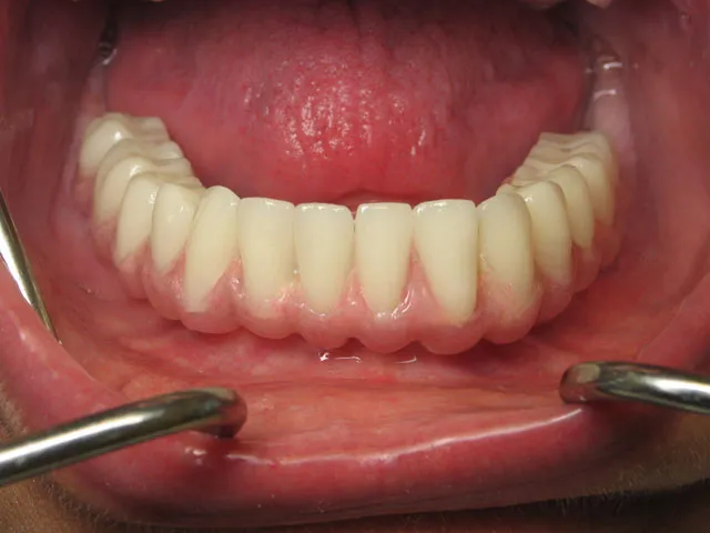 Smile Gallery image