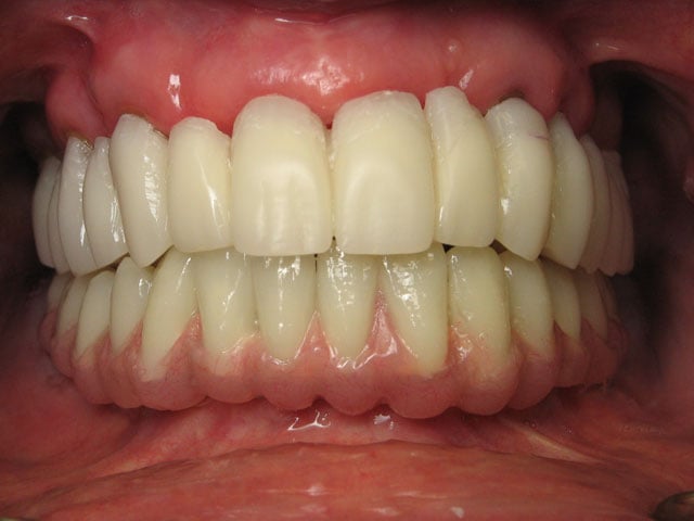 Smile Gallery image