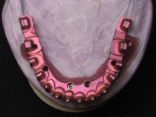 Smile Gallery image