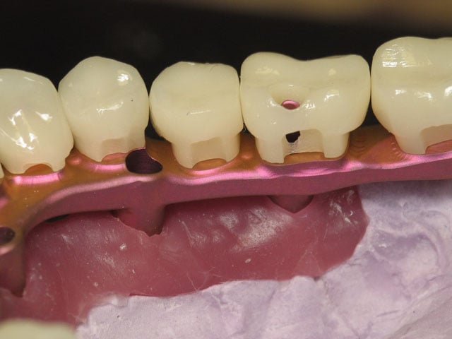 Smile Gallery image