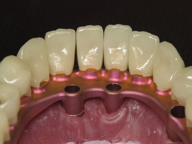 Smile Gallery image