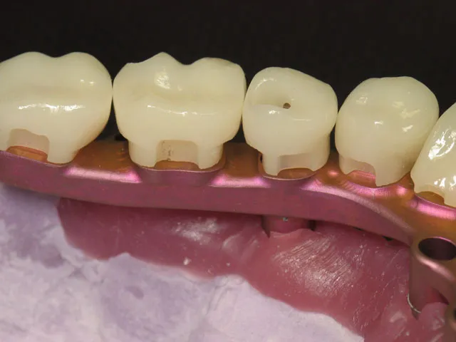 Smile Gallery image