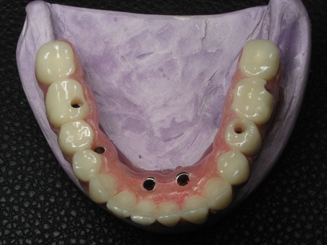 Smile Gallery image