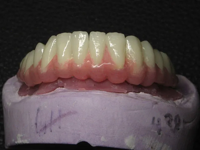 Smile Gallery image