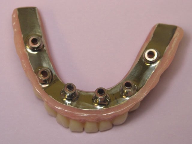 Smile Gallery image