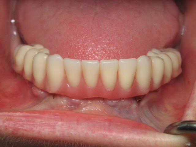 Smile Gallery image