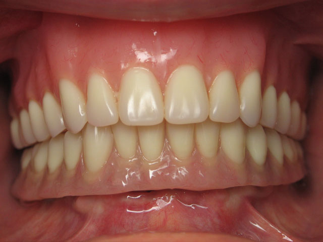 Smile Gallery image
