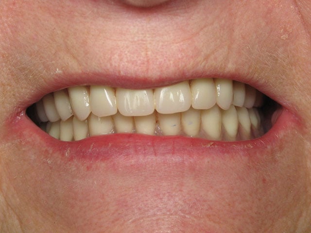 Smile Gallery image