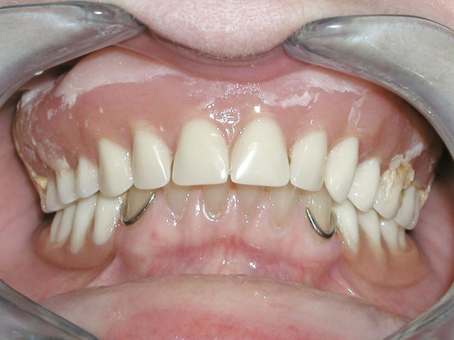 Smile Gallery image