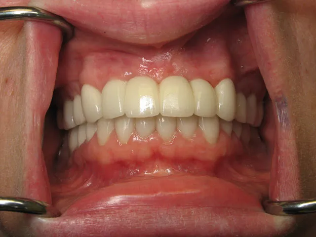 Smile Gallery image