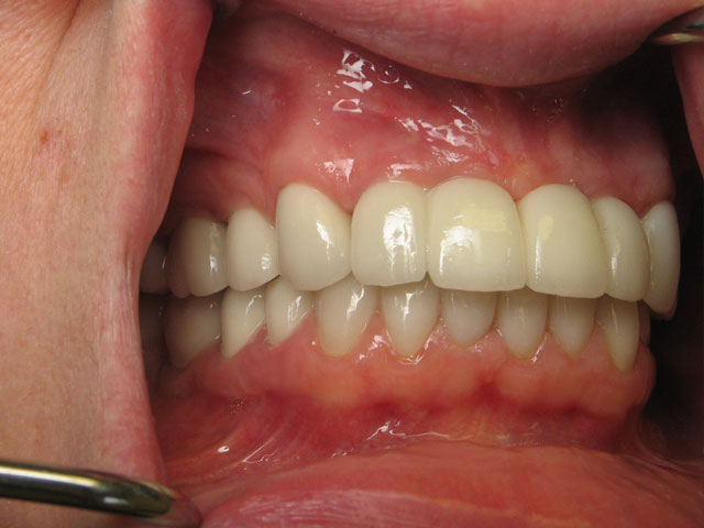 Smile Gallery image