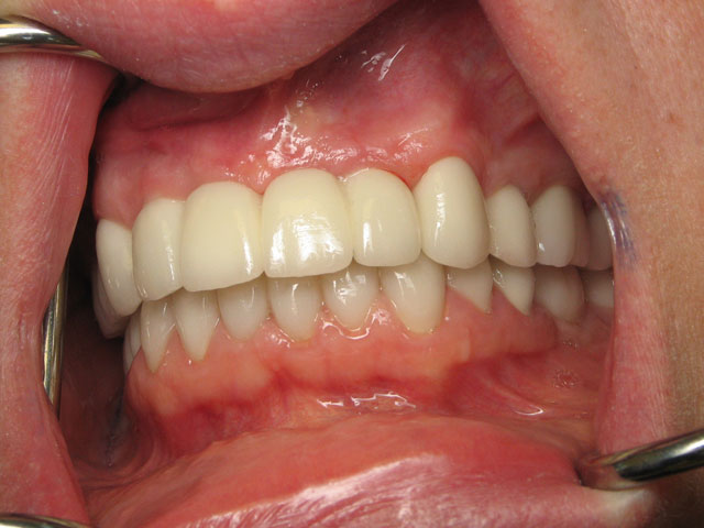 Smile Gallery image