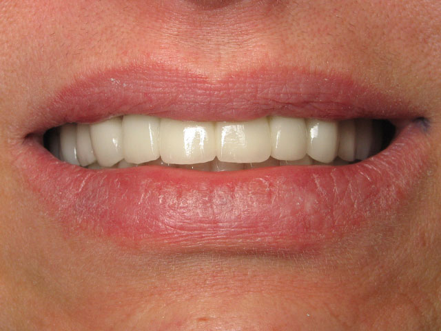 Smile Gallery image