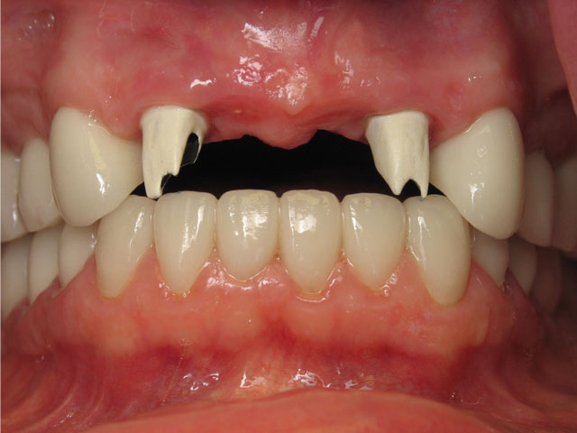 Smile Gallery image