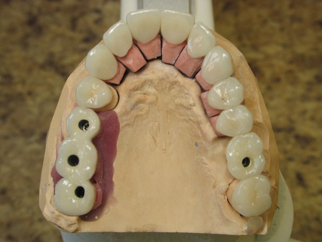 Smile Gallery image