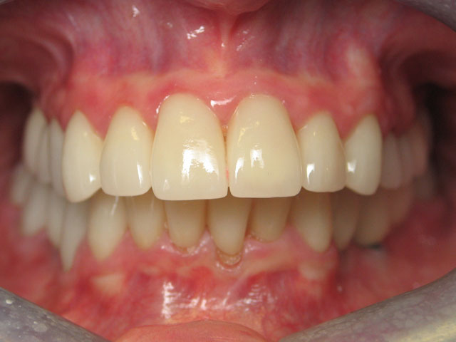 Smile Gallery image