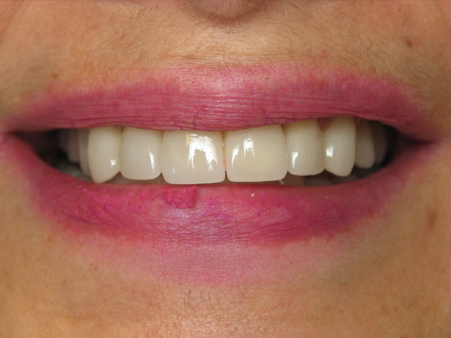Smile Gallery image