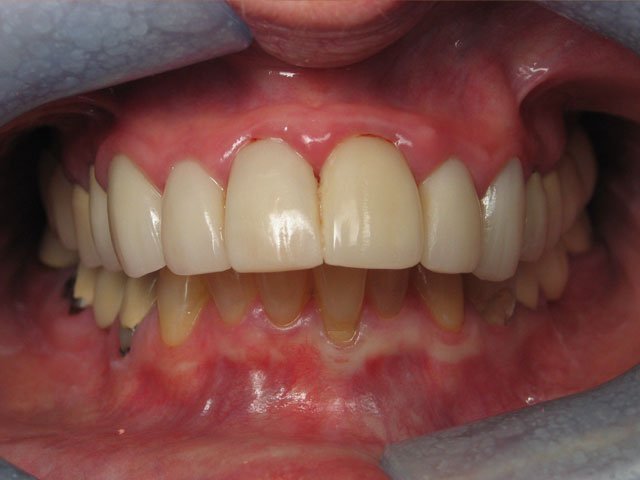 Smile Gallery image