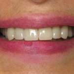 patient with new smile, Northshore Dental