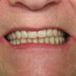 new smile, Roslyn, NY