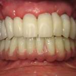 smile close-up, Roslyn, NY