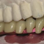 Smile Gallery image
