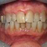 Smile Gallery image