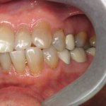 Smile Gallery image