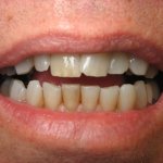Smile Gallery image