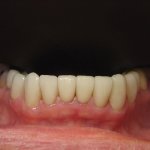 Smile Gallery image