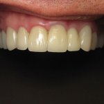 Smile Gallery image