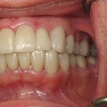 Smile Gallery image