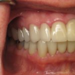 Smile Gallery image