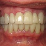 Smile Gallery image