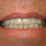 patient with new smile, Dr. Gardner