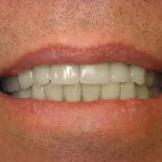 patient with new smile, Dr. Gardner