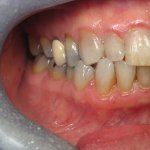 Smile Gallery image