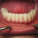 Smile Gallery image