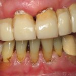 Smile Gallery image
