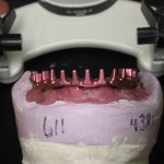 Smile Gallery image