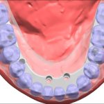 Smile Gallery image