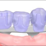 Smile Gallery image