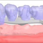 Smile Gallery image