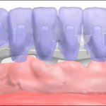 Smile Gallery image