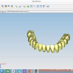 Smile Gallery image
