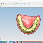 Smile Gallery image