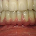 Smile Gallery image