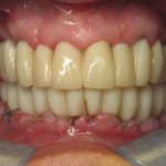 close-up of patient's smile, North Shore Dental
